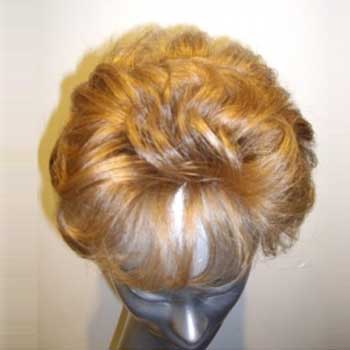 Apliques / Aplopecia