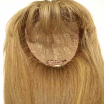 Apliques / Aplopecia